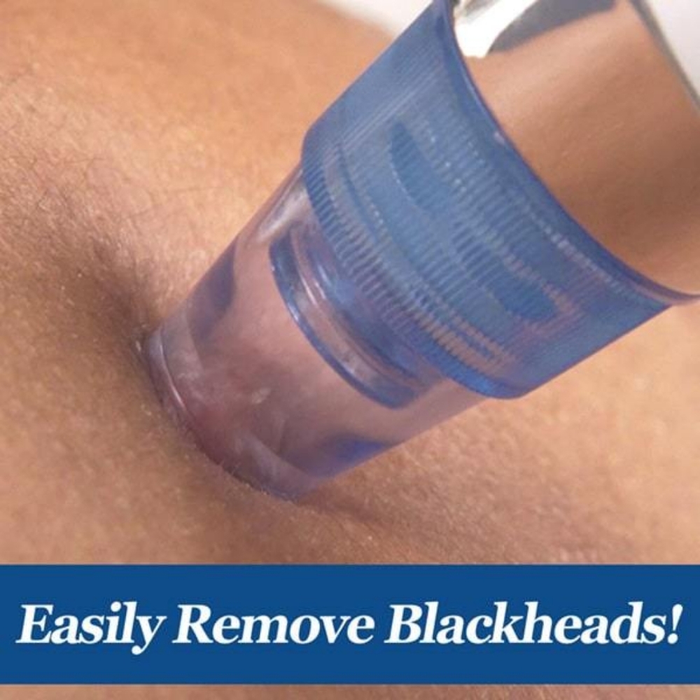 Bulbhead DermaSuction Blackhead Remover - Picture 3 of 6